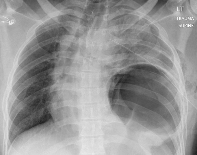 Case 6a