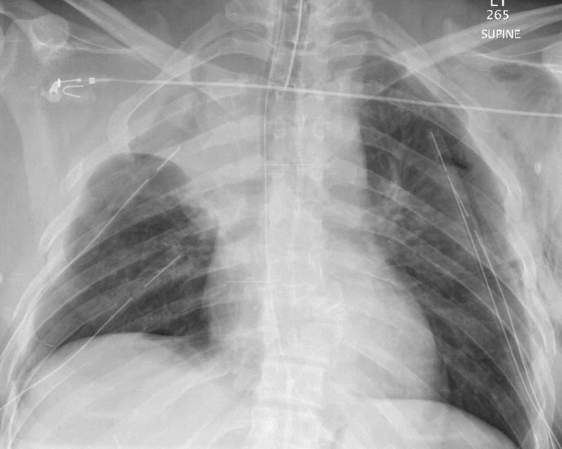 Case 5a