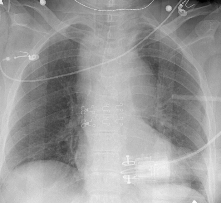 Case 2a