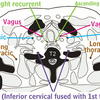 Nerves of the Thorax
Aquino et al Radiographics 2001;21:1275-1281
Images reproduced by permission of the publisher